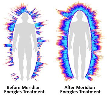 Análisis de la medición del campo de energía humano